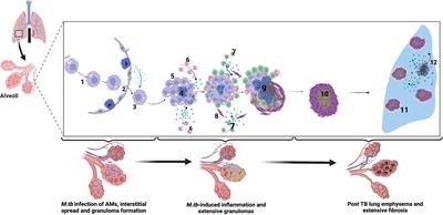 Mechanisms of lung damage in tuberculosis: implications for chronic obstructive pulmonary disease